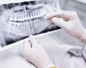 Wurzelkanalbehandlung: Wann ist sie wirklich notwendig?