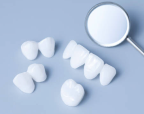 Blendendes Gebiss: Drei Fragen zu Veneers in der ästhetischen Zahnmedizin