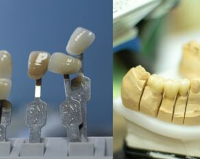 Was moderne CAD/CAM-Technik alles kann