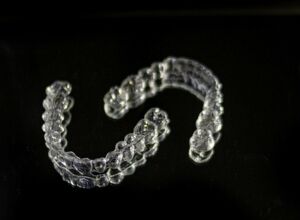 Kieferorthopädie in jedem Alter – aber nicht alles wird erstattet