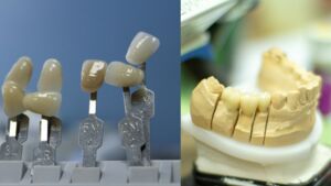 Was moderne CAD/CAM-Technik alles kann